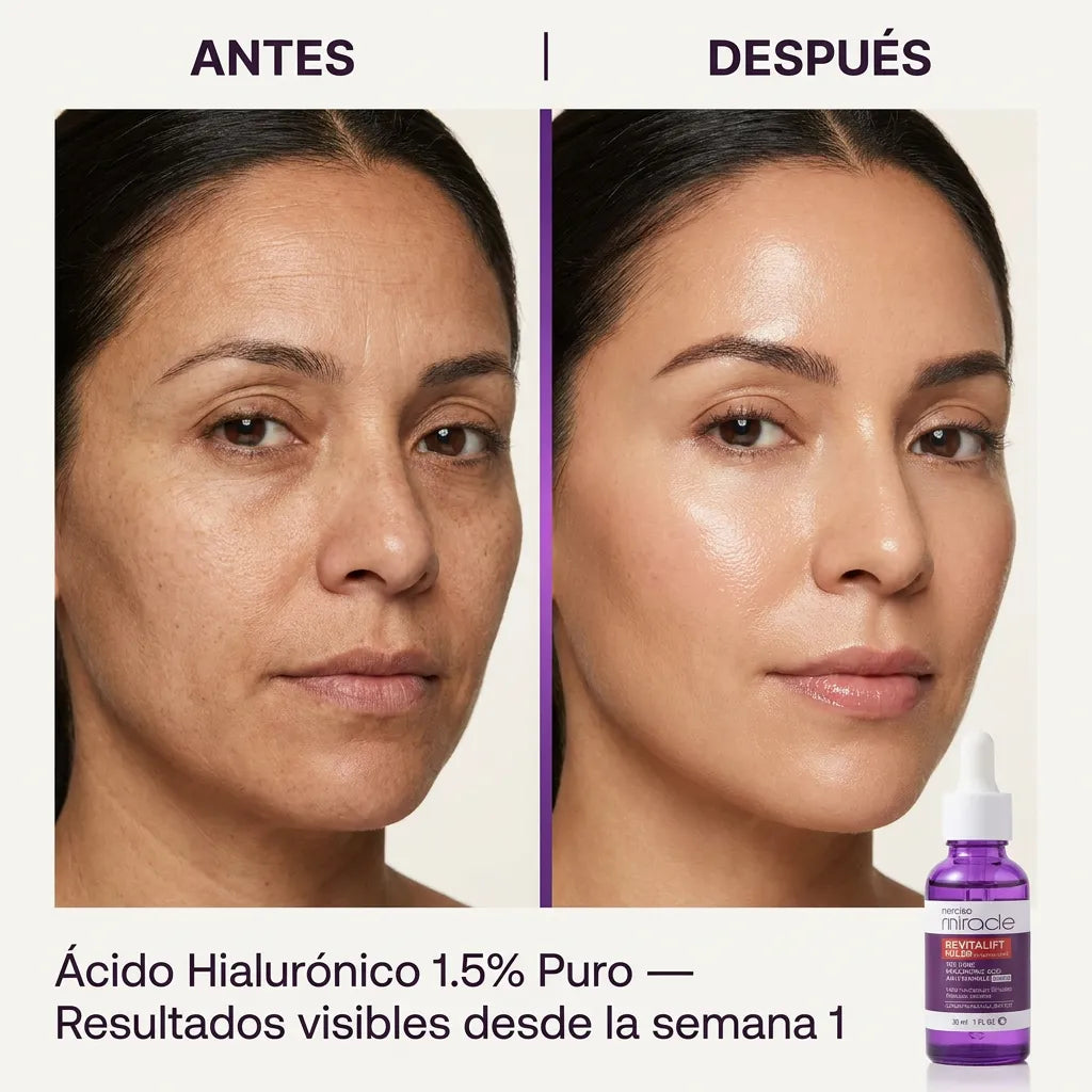 Serum Revitalift Filler 30 ml